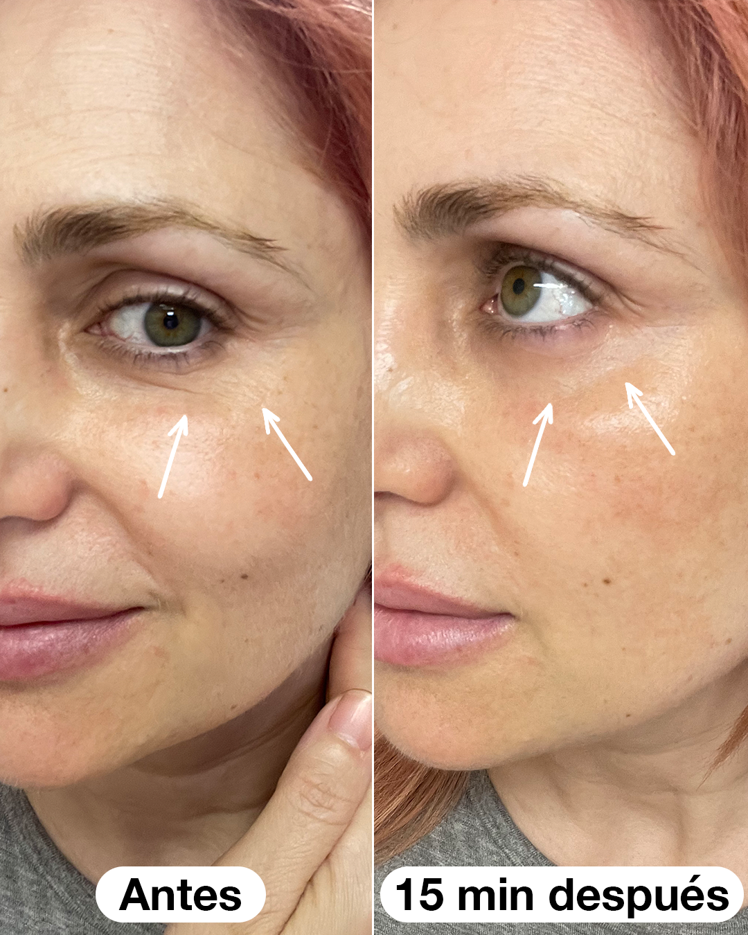 Sérum Roll-on Eye Salad Code 10 ml