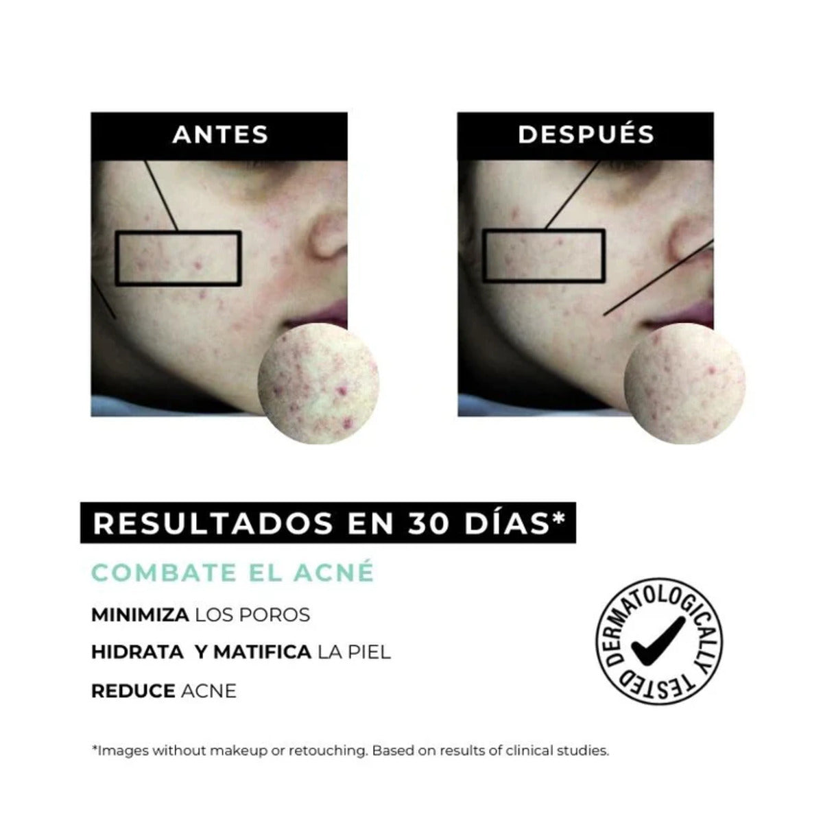 Equilibrium crème tegen acne voor de vette huid Arganour 30 ml