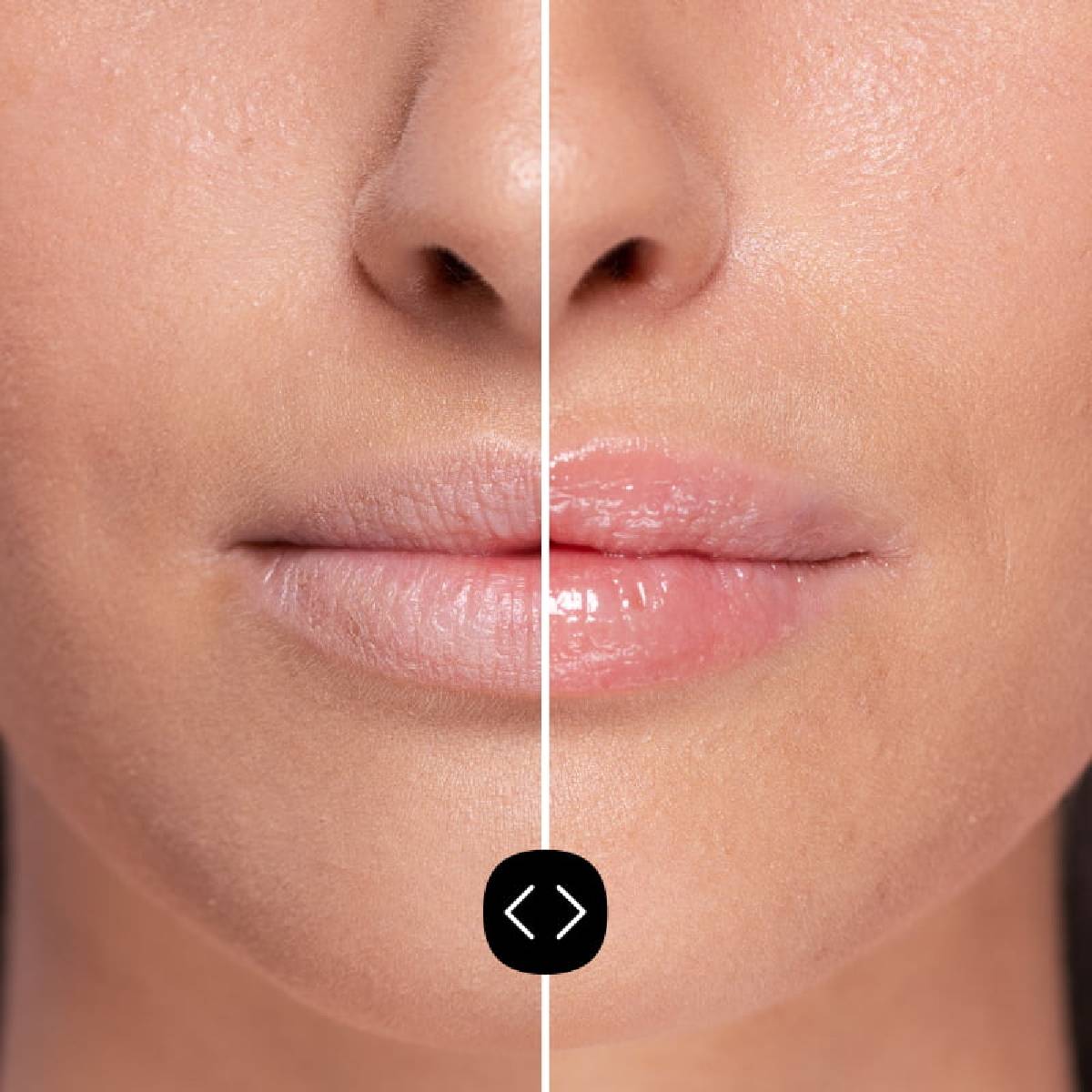 Freshly Hyaluronsäure-Lippenvolumizer 5 ml