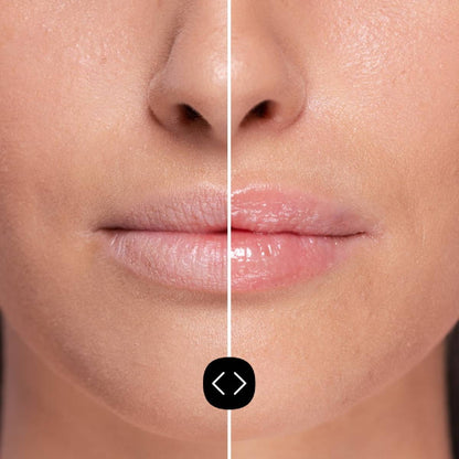 Freshly Hyaluronsäure-Lippenvolumizer 5 ml